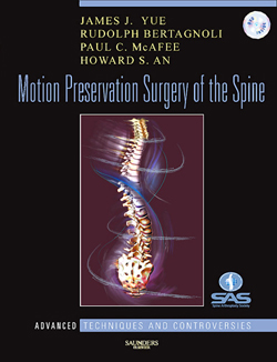 Motion Preservation of the Spine